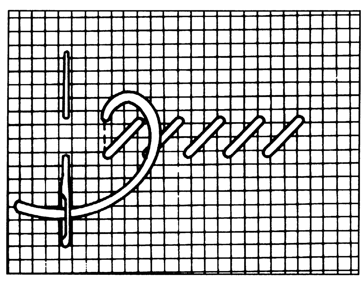 Schwarz-weißer Grafikstich, handgemacht, lineares Muster, modisch, DIY, geometrische Präzision.